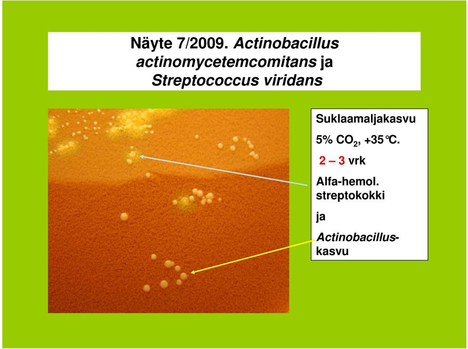 Streptococcus viridans Suklaamaljakasvu