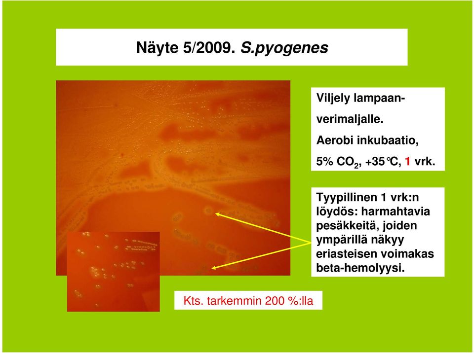 Tyypillinen 1 vrk:n löydös: harmahtavia pesäkkeitä,