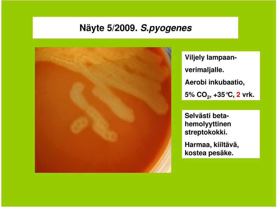 Aerobi inkubaatio, 5% CO 2, +35 C, 2 vrk.