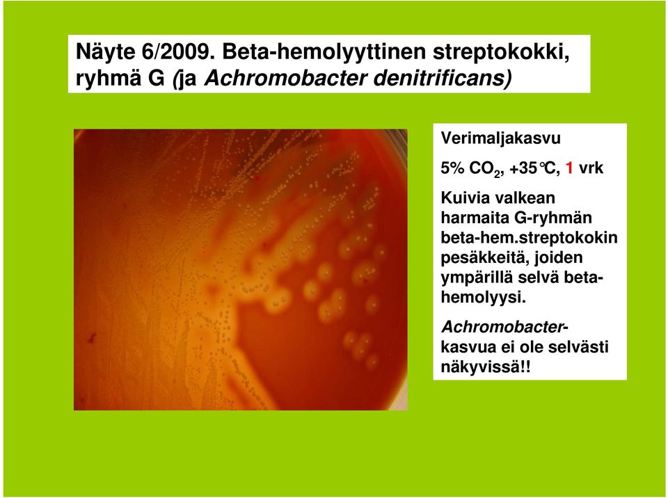 denitrificans) Verimaljakasvu 5% CO 2, +35 C, 1 vrk Kuivia valkean