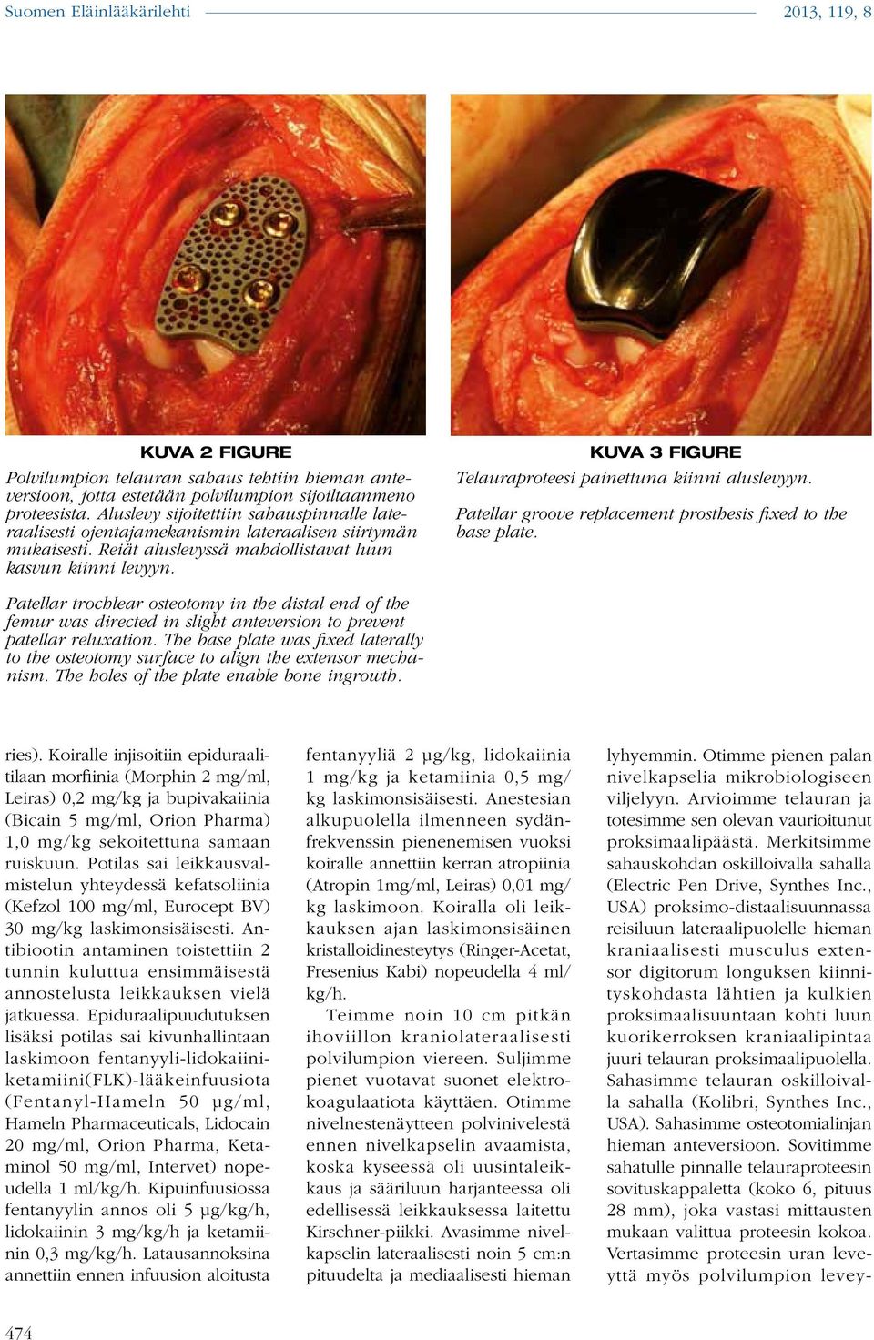 KUVA 3 FIGURE Telauraproteesi painettuna kiinni aluslevyyn. Patellar groove replacement prosthesis fixed to the base plate.