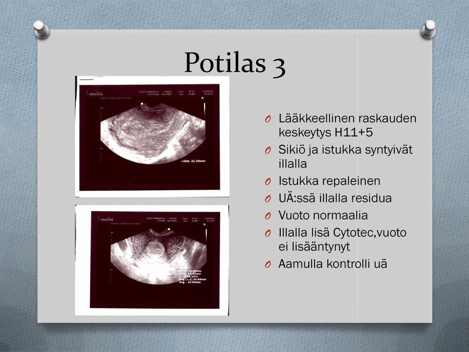 repaleinen O UÄ:ssä illalla residua O Vuoto normaalia