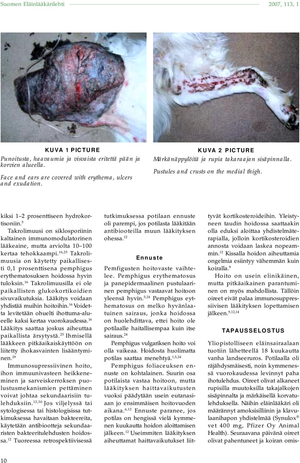 5 Takrolimuusi on siklosporiinin kaltainen immunomodulatorinen lääkeaine, mutta arviolta 10 100 kertaa tehokkaampi.