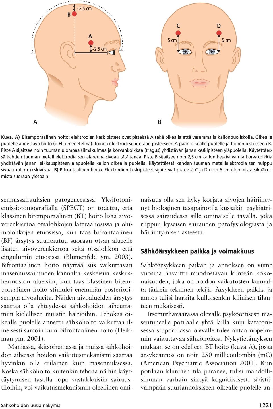 Piste A sijaitsee noin tuuman ulompaa silmäkulmaa ja korvankolkkaa (tragus) yhdistävän janan keskipisteen yläpuolella. Käytettäessä kahden tuuman metallielektrodia sen alareuna sivuaa tätä janaa.