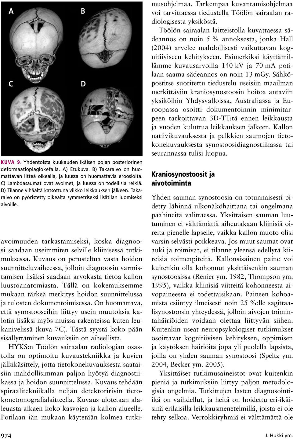 D avoimuuden tarkastamiseksi, koska diagnoosi saadaan useimmiten selville kliinisessä tutkimuksessa.