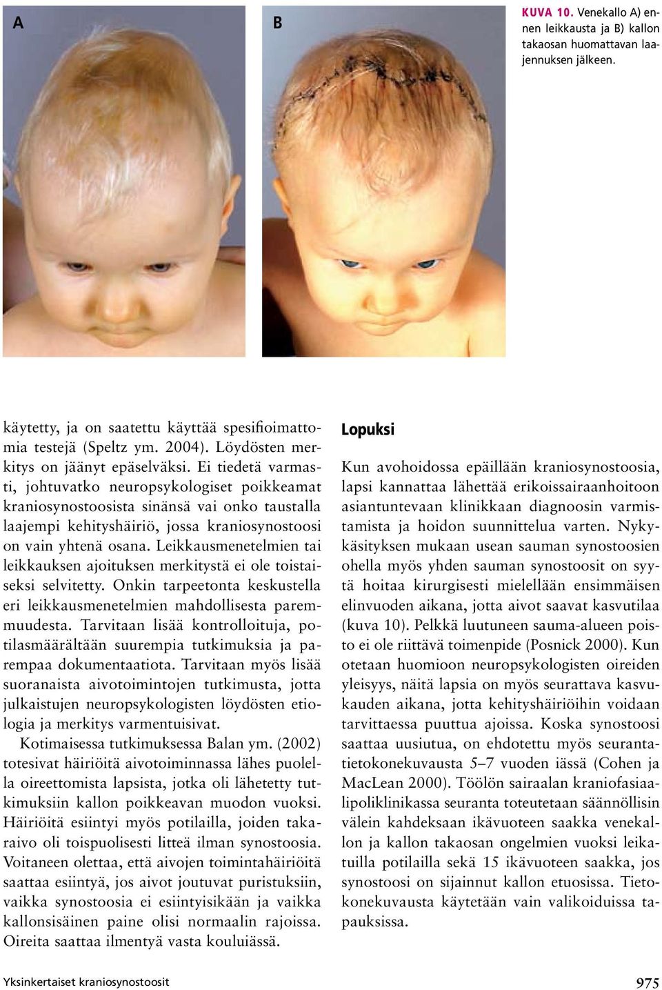 Ei tiedetä varmasti, johtuvatko neuropsykologiset poikkeamat kraniosynostoosista sinänsä vai onko taustalla laajempi kehityshäiriö, jossa kraniosynostoosi on vain yhtenä osana.