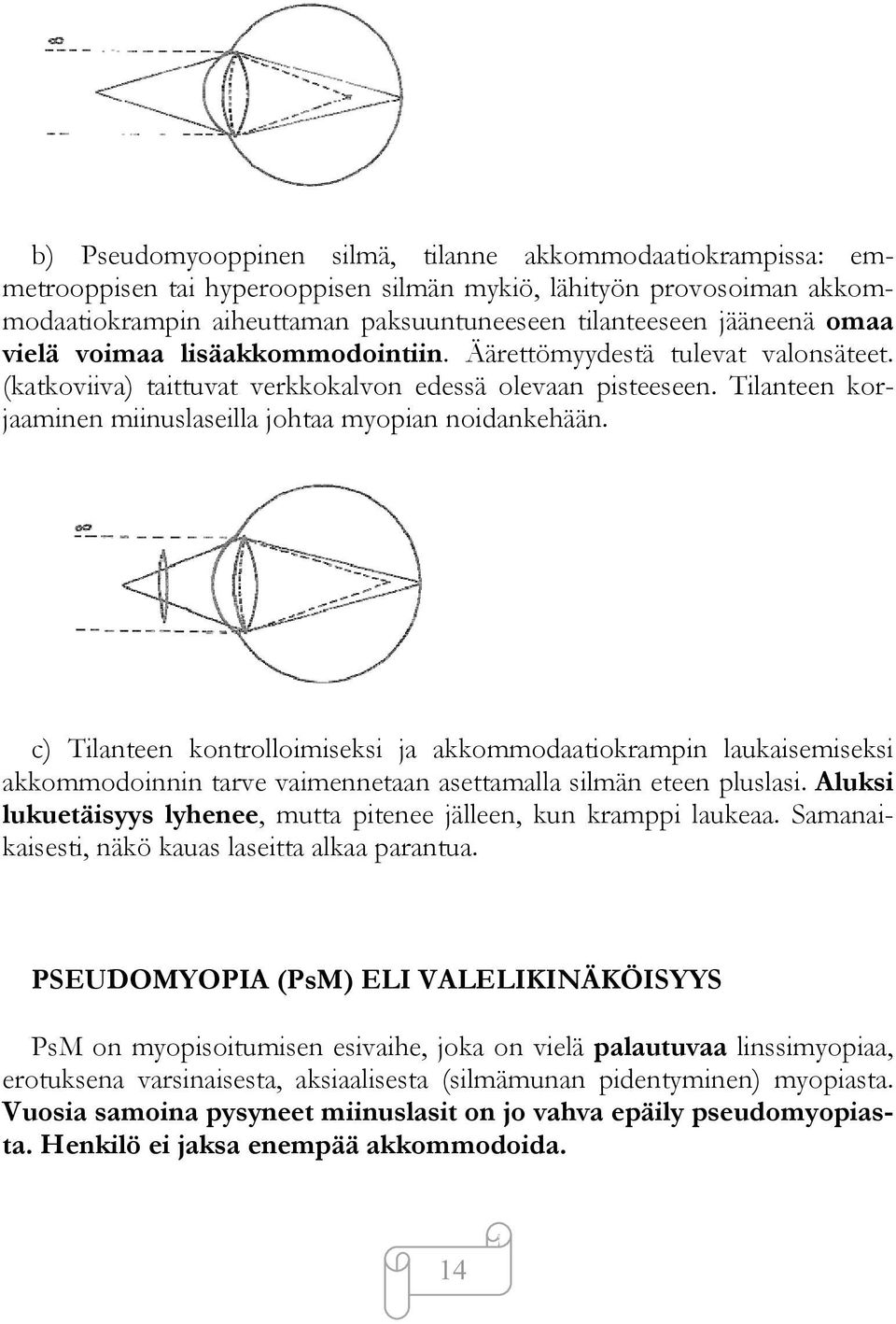 Tilanteen korjaaminen miinuslaseilla johtaa myopian noidankehään.