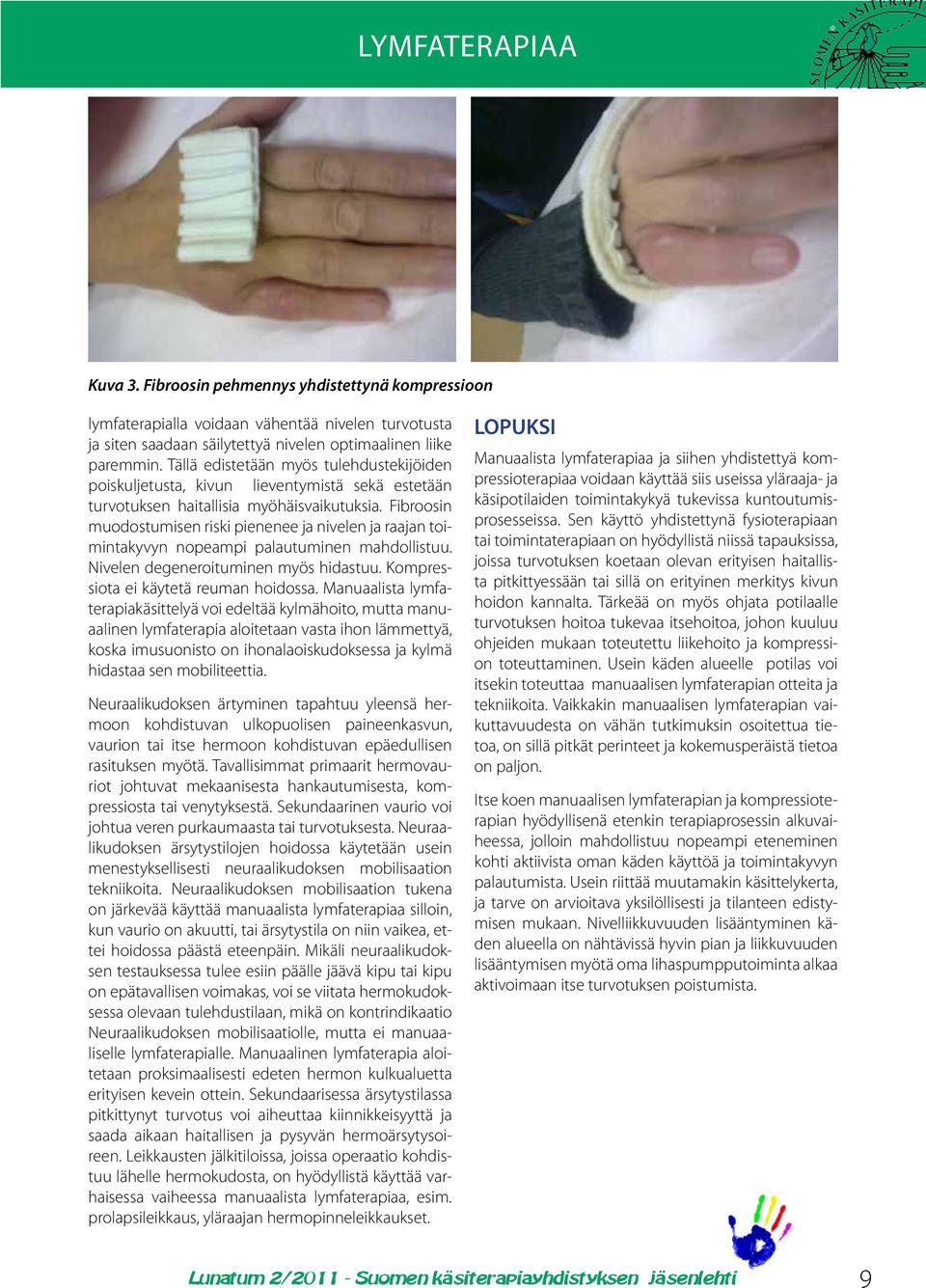 Fibroosin muodostumisen riski pienenee ja nivelen ja raajan toimintakyvyn nopeampi palautuminen mahdollistuu. Nivelen degeneroituminen myös hidastuu. Kompressiota ei käytetä reuman hoidossa.