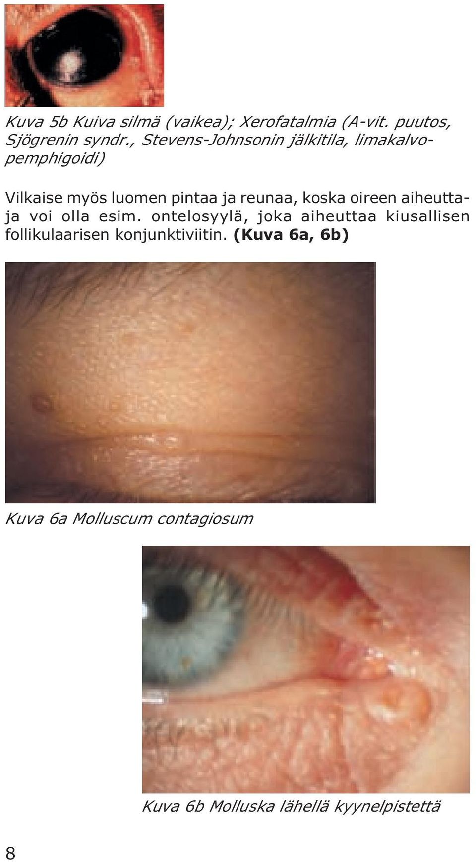reunaa, koska oireen aiheuttaja voi olla esim.