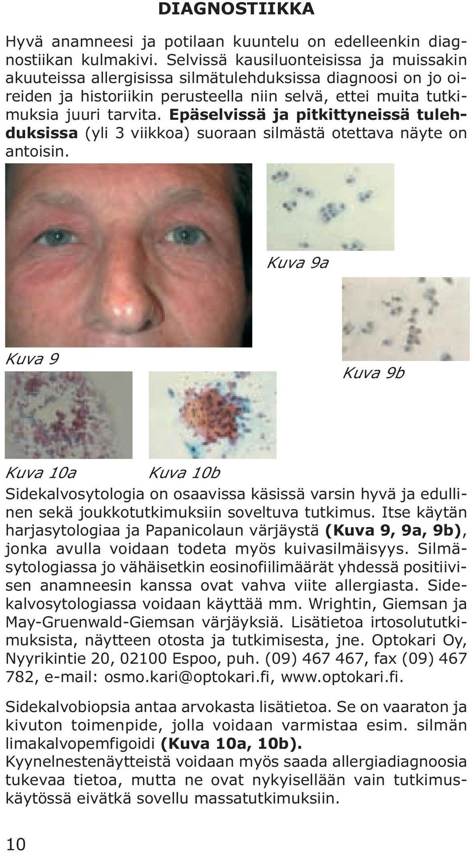 Epäselvissä ja pitkittyneissä tulehduksissa (yli 3 viikkoa) suoraan silmästä otettava näyte on antoisin.
