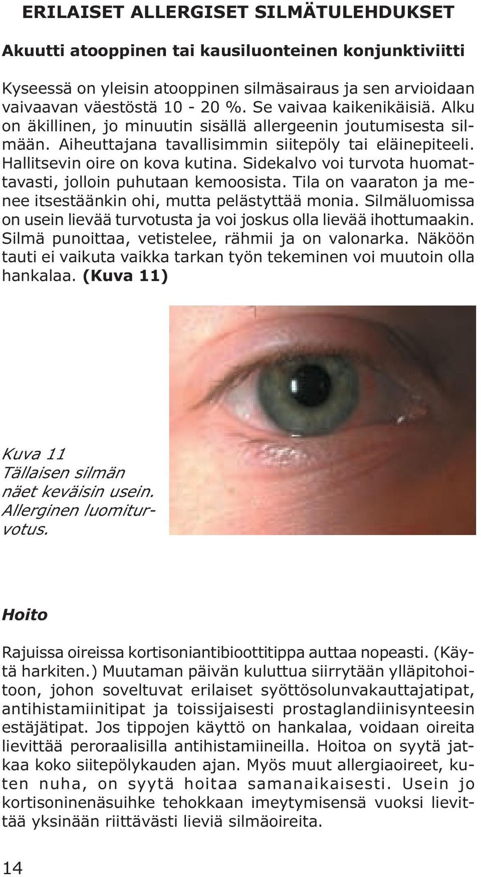 Sidekalvo voi turvota huomattavasti, jolloin puhutaan kemoosista. Tila on vaaraton ja menee itsestäänkin ohi, mutta pelästyttää monia.
