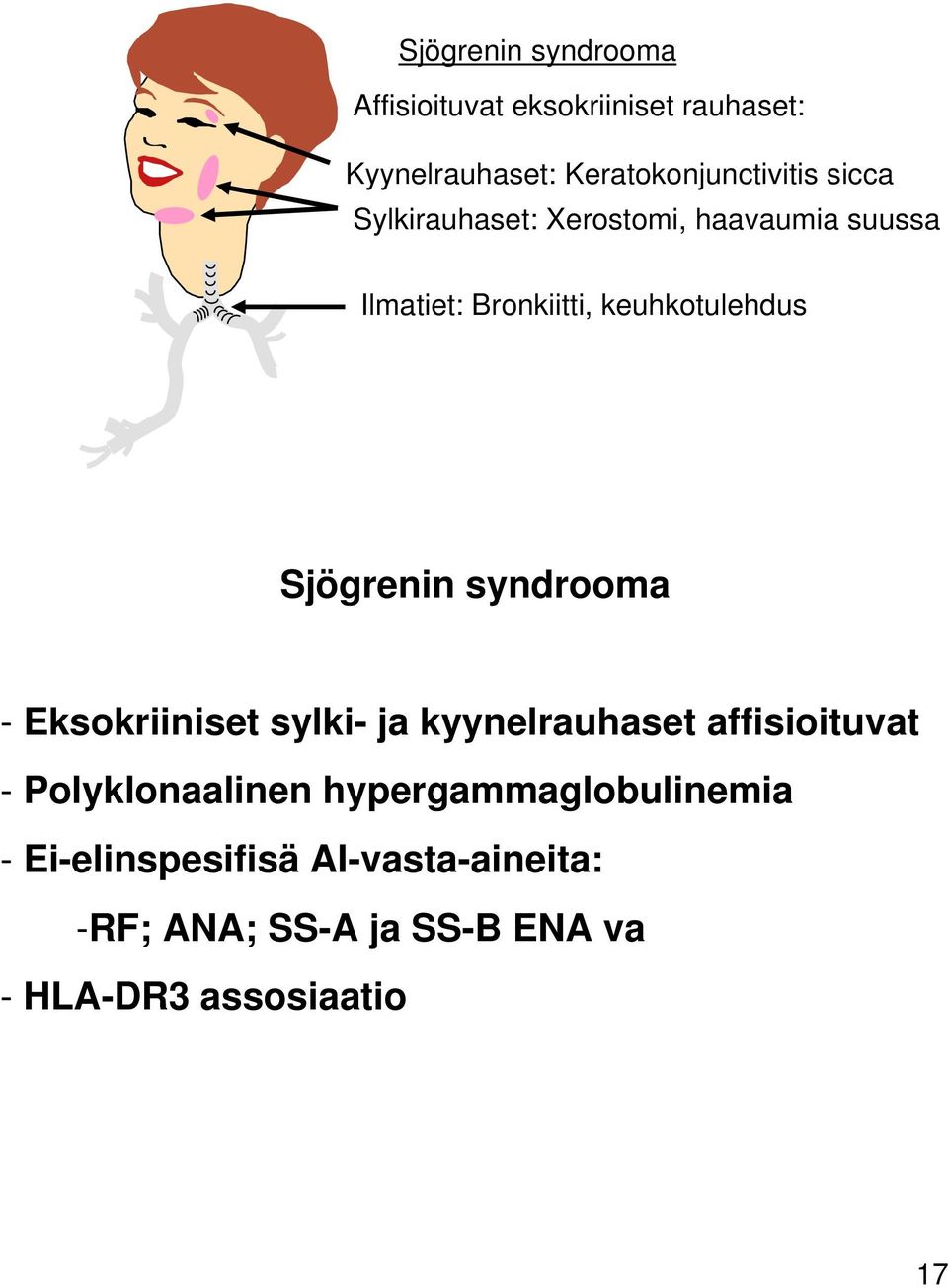 syndrooma - Eksokriiniset sylki- ja kyynelrahaset affisioitvat - Polyklonaalinen