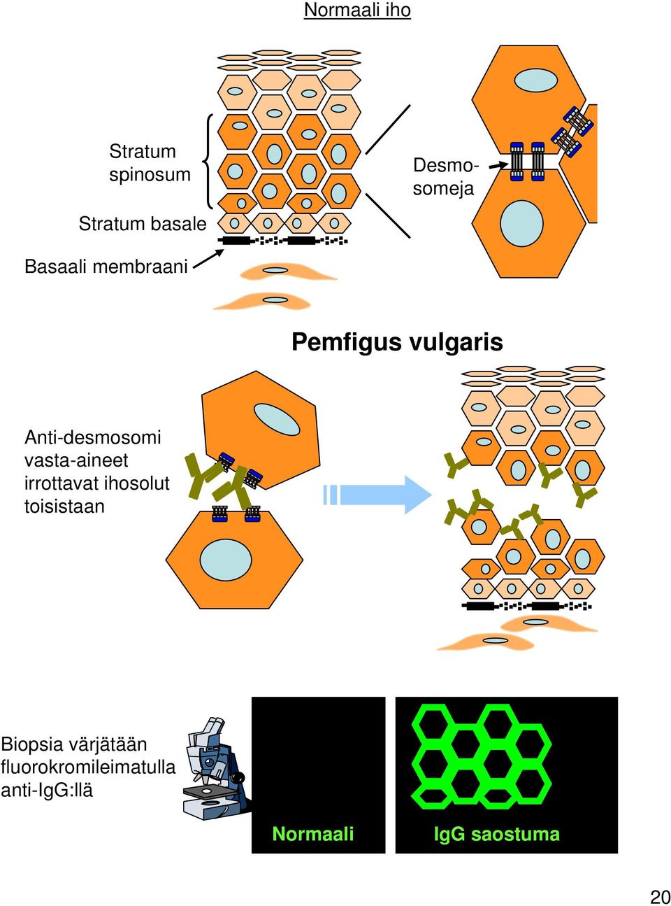 vasta-aineet irrottavat ihosolt toisistaan Biopsia