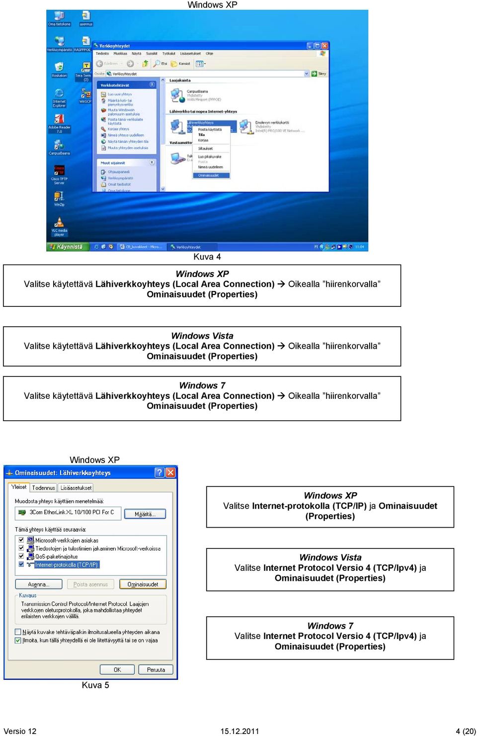 Lähiverkkoyhteys (Local Area Connection) Oikealla hiirenkorvalla Ominaisuudet (Properties) Valitse Internet-protokolla (TCP/IP) ja Ominaisuudet (Properties)