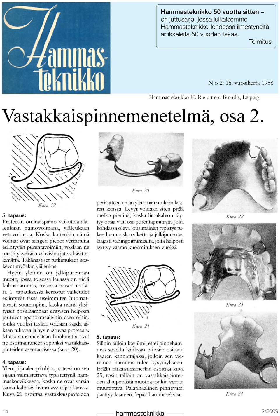 Koska kuitenkin nämä voimat ovat sangen pienet verrattuna esiintyviin purentavoimiin, voidaan ne merkitykseltään vähäisinä jättää käsittelemättä. Tähänastiset tutkimukset koskevat myöskin yläleukaa.