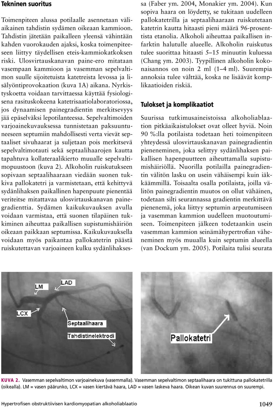 Ulosvirtauskanavan paine ero mitataan vasempaan kammioon ja vasemman sepelvaltimon suulle sijoitetuista katetreista levossa ja lisälyöntiprovokaation (kuva 1A) aikana.