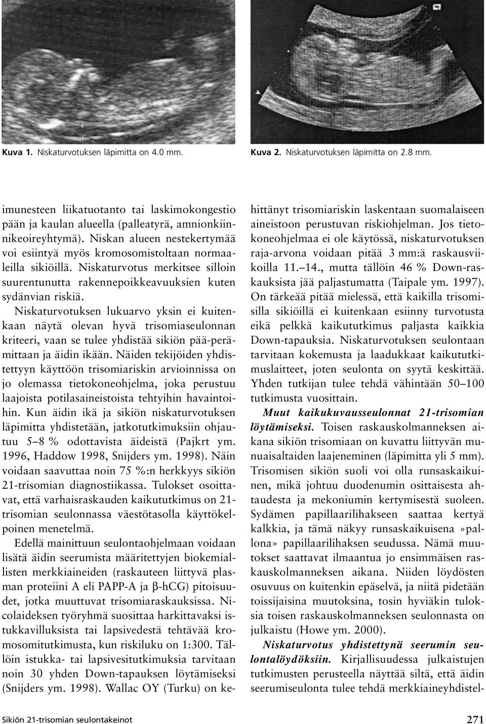 Niskaturvotus merkitsee silloin suurentunutta rakennepoikkeavuuksien kuten sydänvian riskiä.