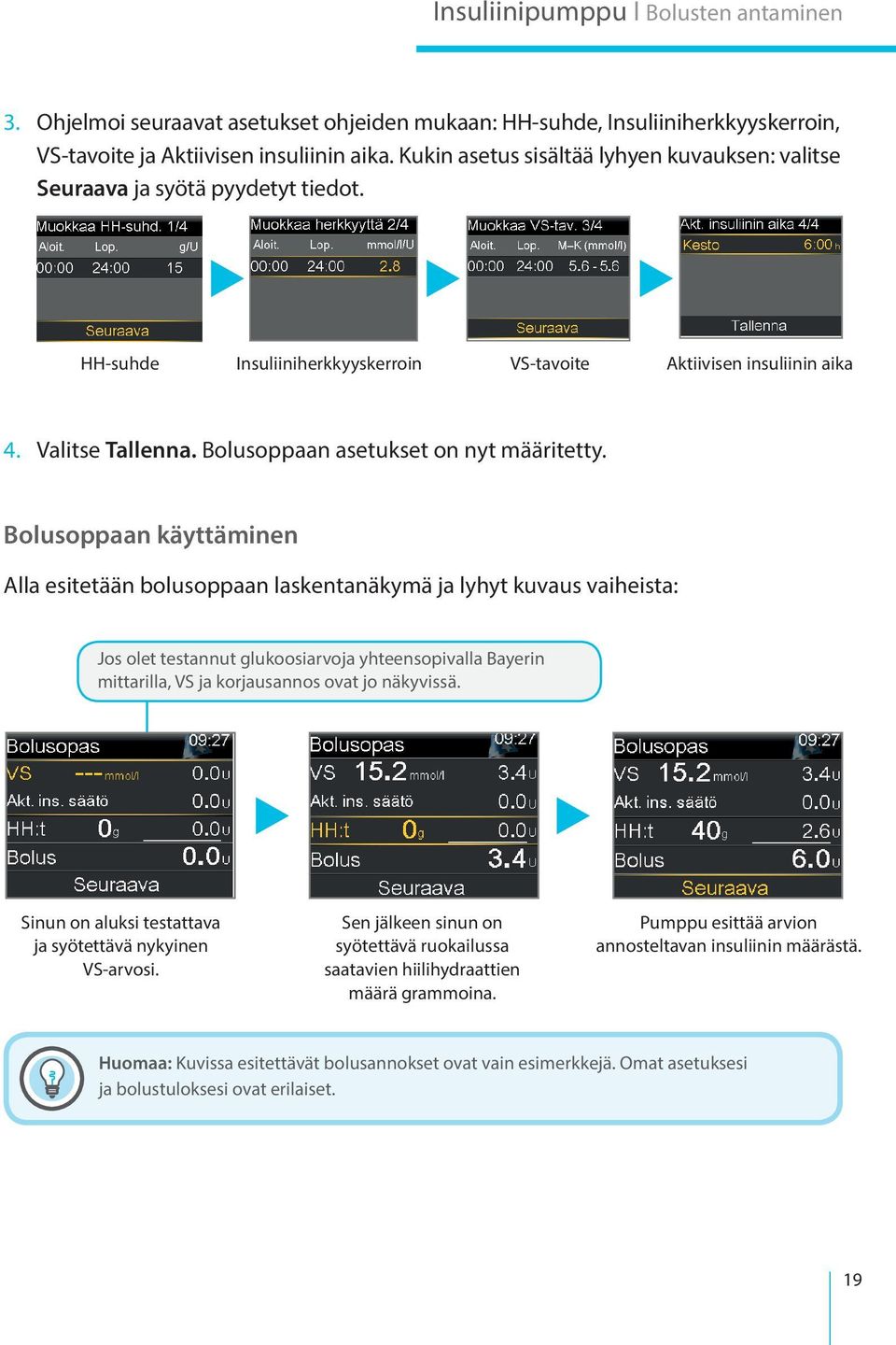 Bolusoppaan asetukset on nyt määritetty.