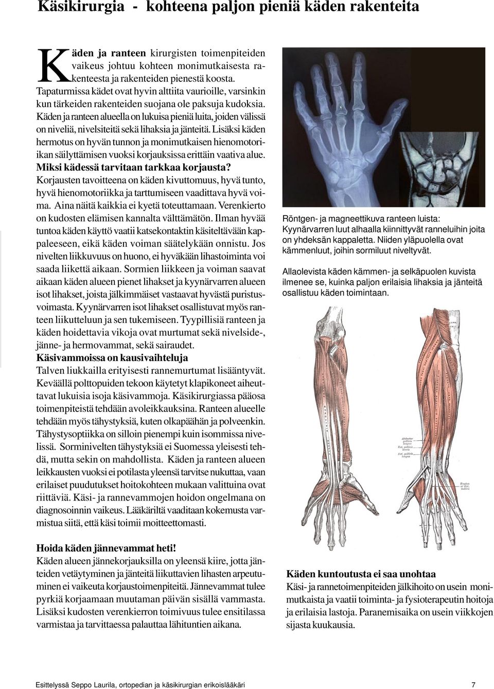 Käden ja ranteen alueella on lukuisa pieniä luita, joiden välissä on niveliä, nivelsiteitä sekä lihaksia ja jänteitä.