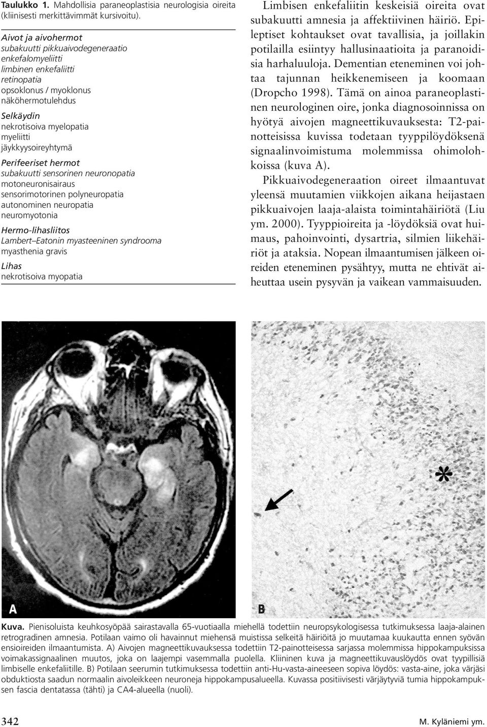 jäykkyysoireyhtymä Perifeeriset hermot subakuutti sensorinen neuronopatia motoneuronisairaus sensorimotorinen polyneuropatia autonominen neuropatia neuromyotonia Hermo-lihasliitos Lambert Eatonin