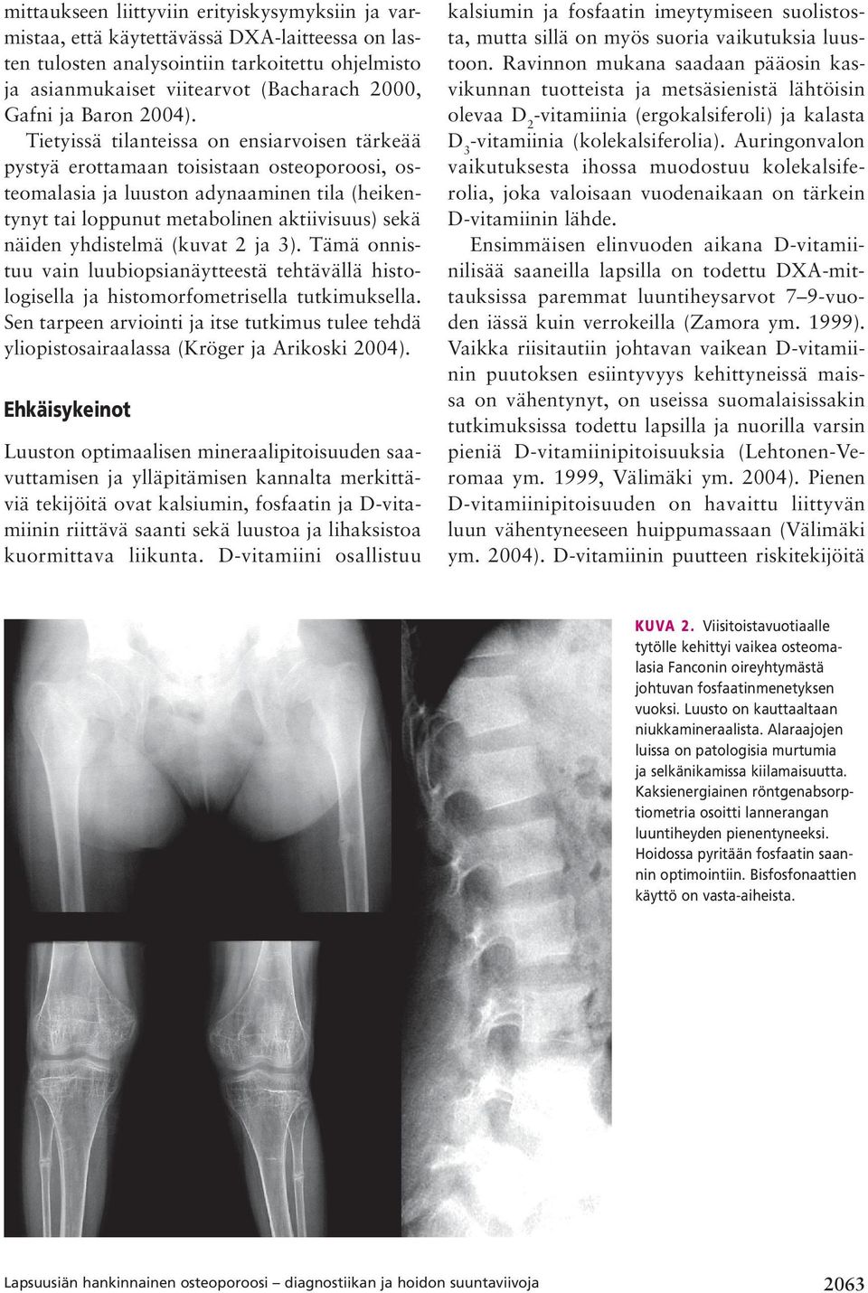 Tietyissä tilanteissa on ensiarvoisen tärkeää pystyä erottamaan toisistaan osteoporoosi, osteomalasia ja luuston adynaaminen tila (heikentynyt tai loppunut metabolinen aktiivisuus) sekä näiden