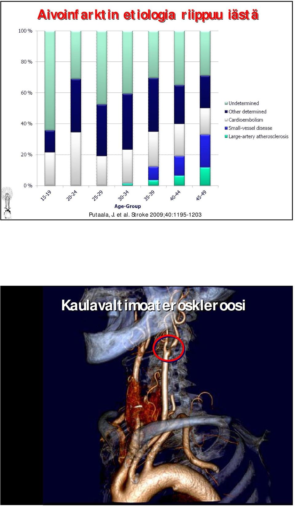 Stroke 2009;40:1195-1203 Kehittyvä