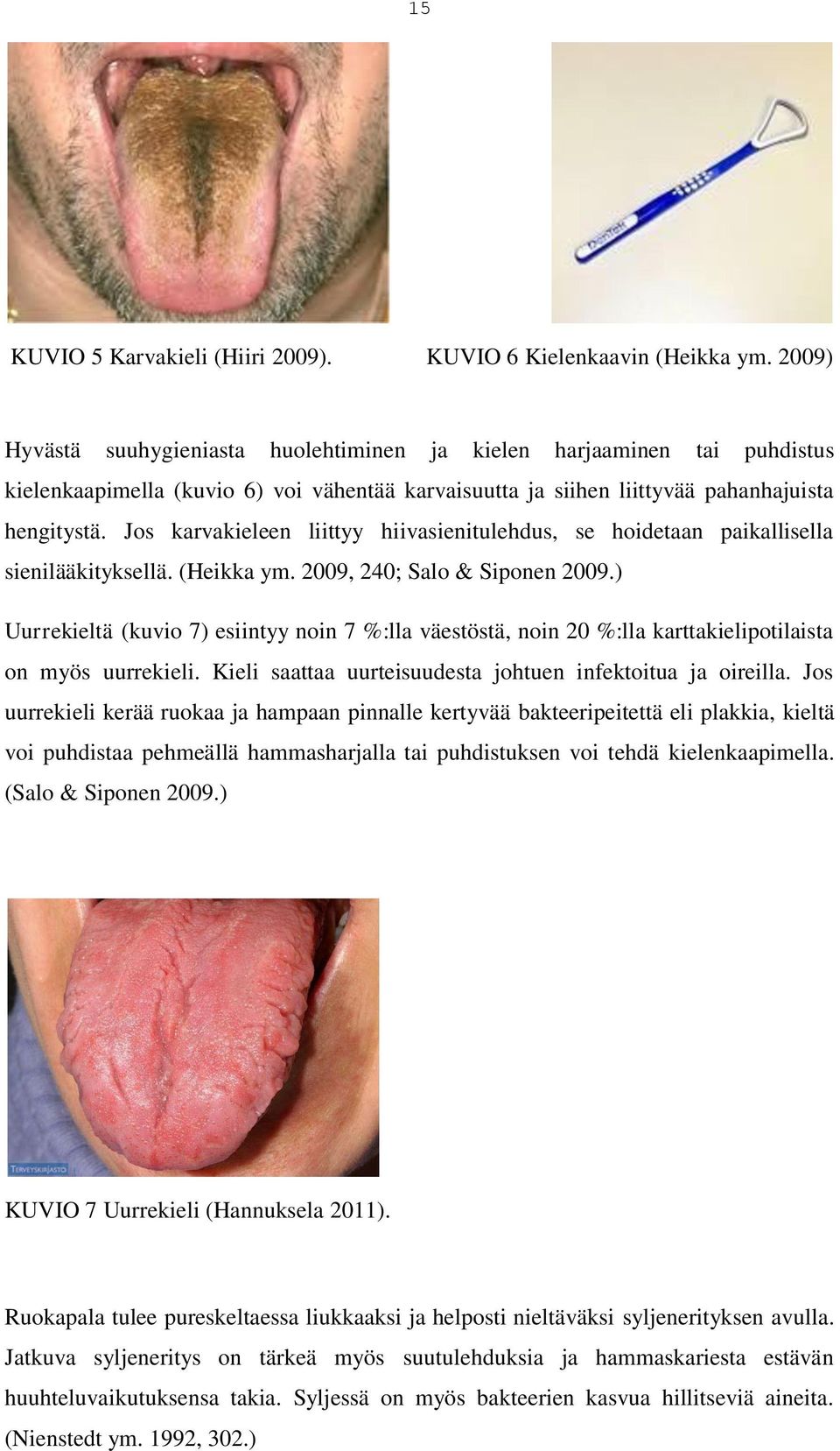 Jos karvakieleen liittyy hiivasienitulehdus, se hoidetaan paikallisella sienilääkityksellä. (Heikka ym. 2009, 240; Salo & Siponen 2009.