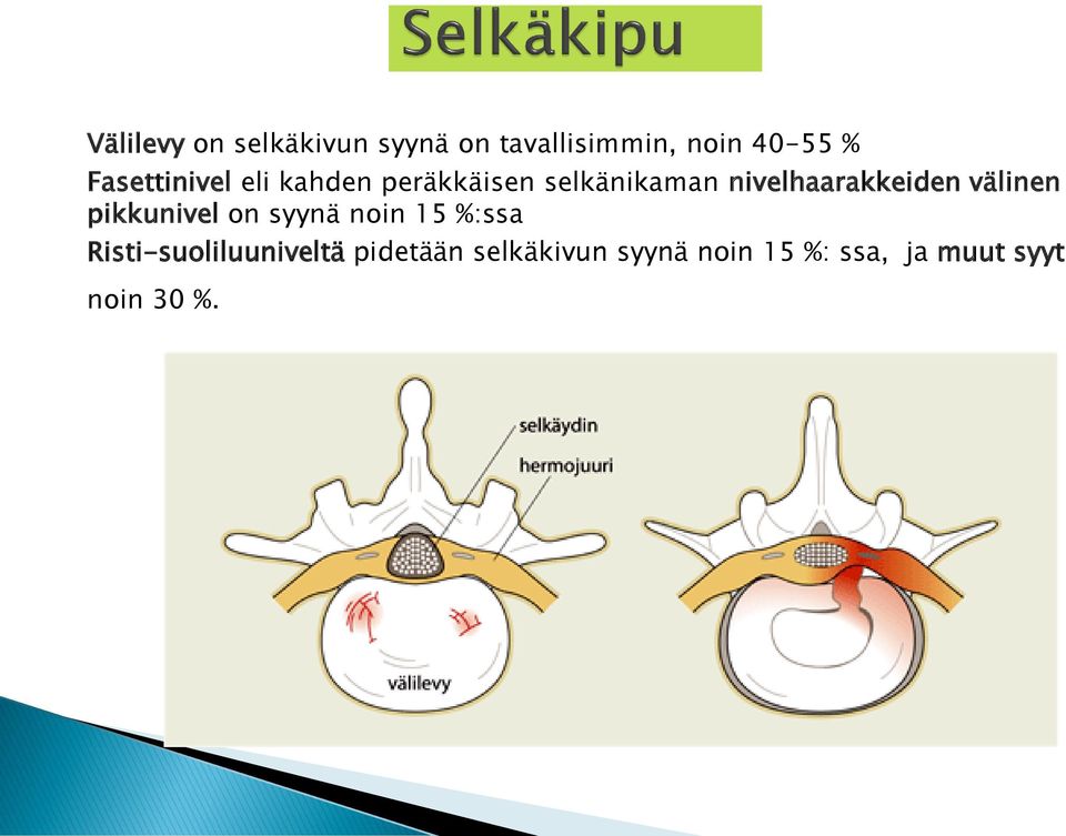 nivelhaarakkeiden välinen pikkunivel on syynä noin 15 %:ssa