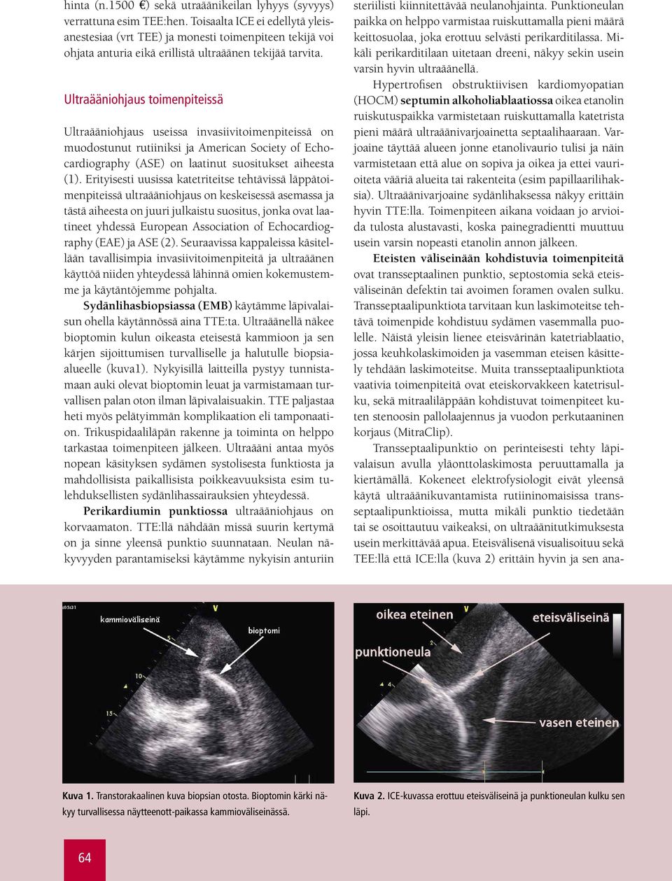 Ultraääniohjaus toimenpiteissä Ultraääniohjaus useissa invasiivitoimenpiteissä on muodostunut rutiiniksi ja American Society of Echocardiography (ASE) on laatinut suositukset aiheesta (1).