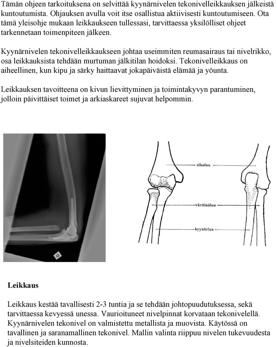 Kyynärnivelen tekonivelleikkaukseen johtaa useimmiten reumasairaus tai nivelrikko, osa leikkauksista tehdään murtuman jälkitilan hoidoksi.