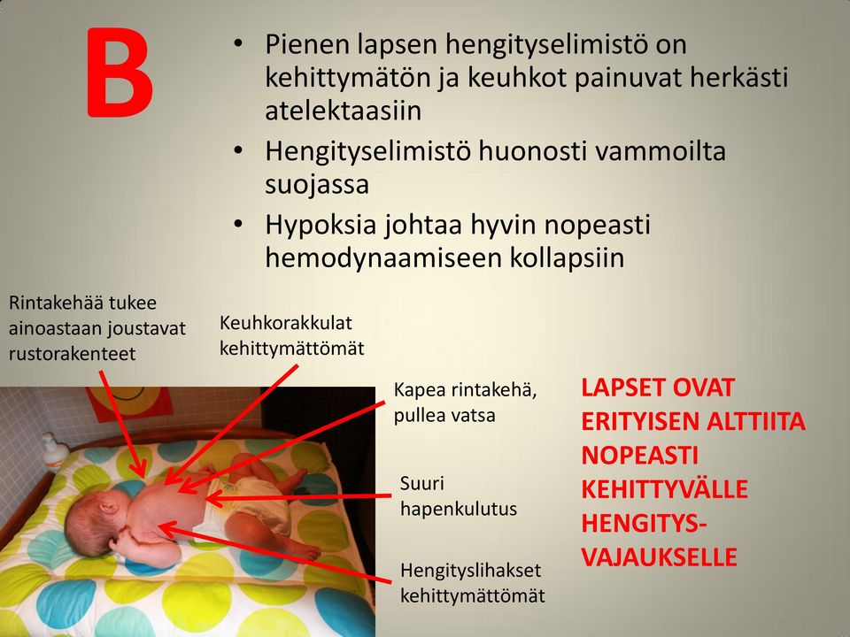 ainoastaan joustavat rustorakenteet Keuhkorakkulat kehittymättömät Kapea rintakehä, pullea vatsa Suuri