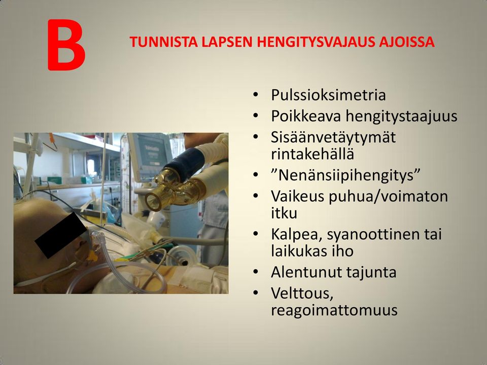 Nenänsiipihengitys Vaikeus puhua/voimaton itku Kalpea,