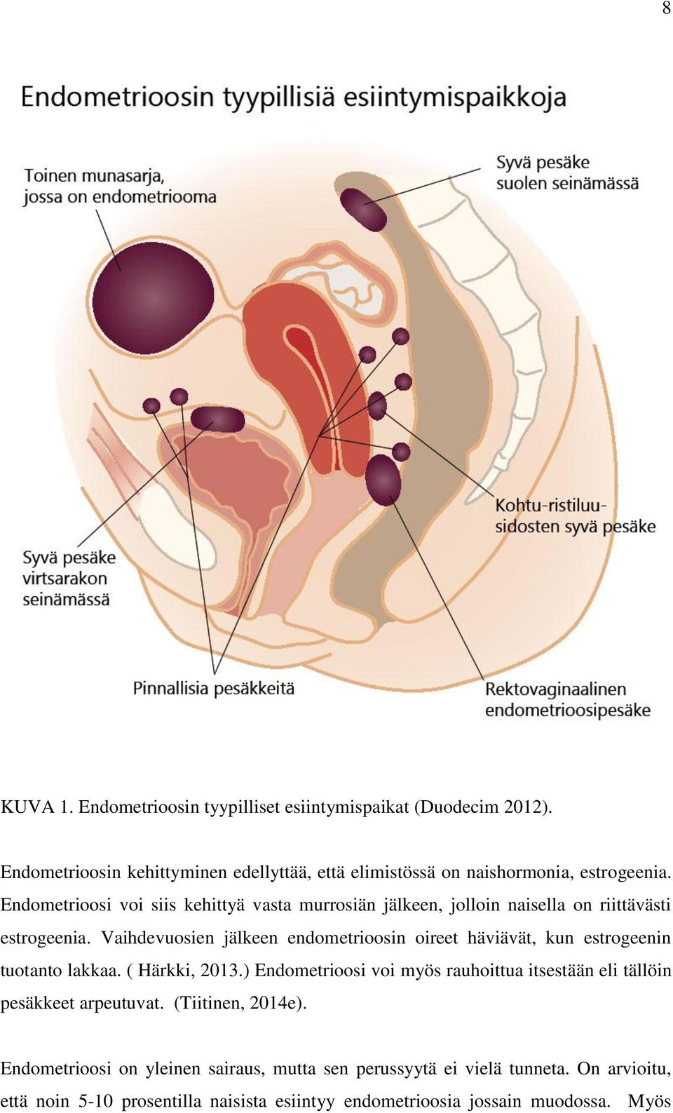 Vaihdevuosien jälkeen endometrioosin oireet häviävät, kun estrogeenin tuotanto lakkaa. ( Härkki, 2013.