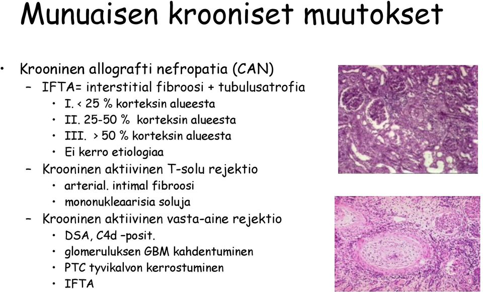 > 50 % korteksin alueesta Ei kerro etiologiaa Krooninen aktiivinen T-solu rejektio arterial.