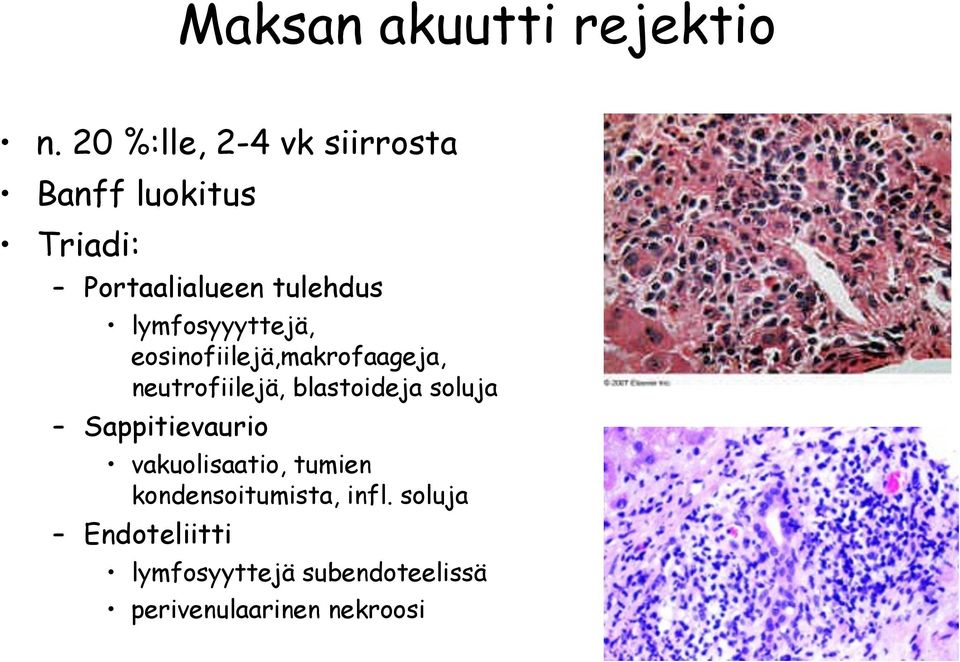 lymfosyyyttejä, eosinofiilejä,makrofaageja, neutrofiilejä, blastoideja soluja