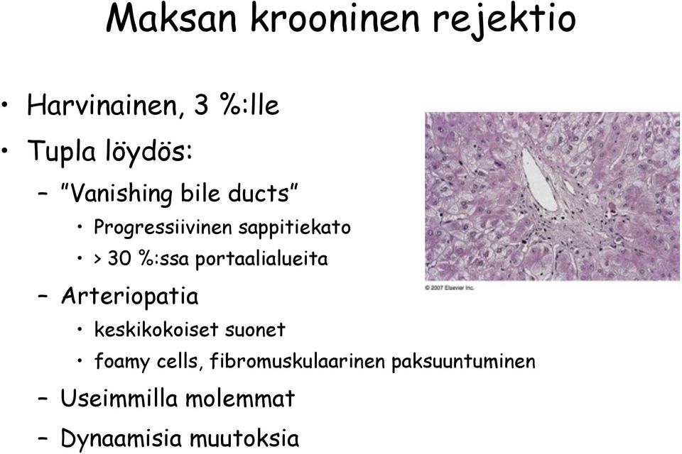 portaalialueita Arteriopatia keskikokoiset suonet foamy cells,