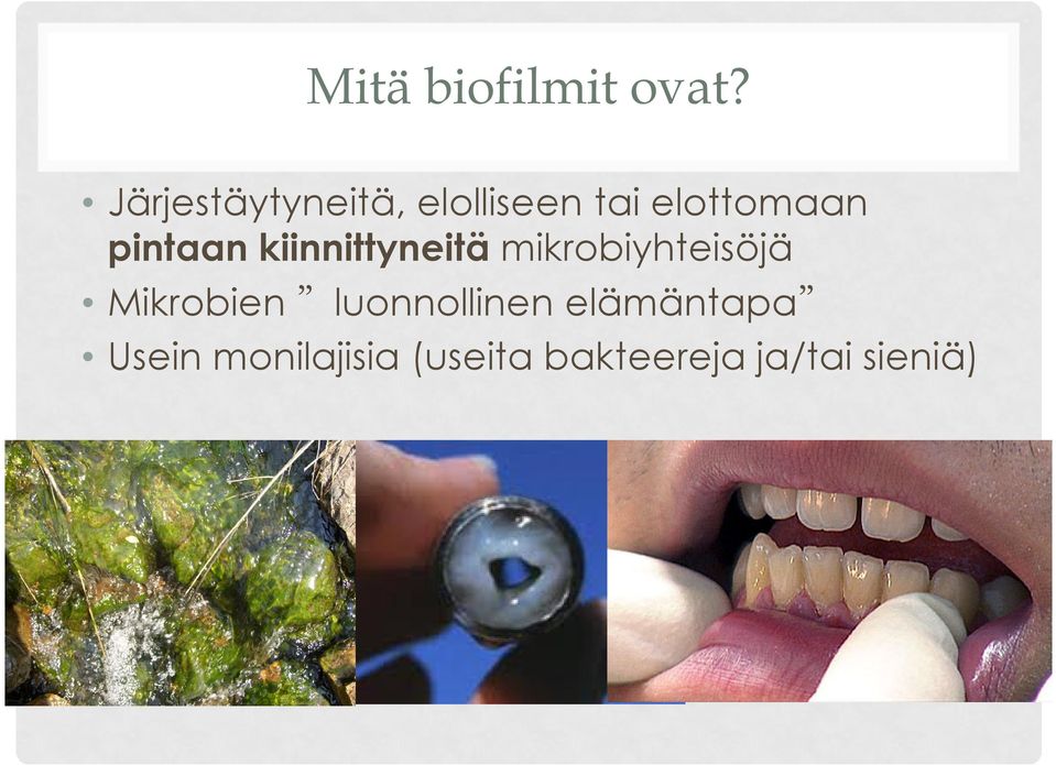 pintaan kiinnittyneitä mikrobiyhteisöjä