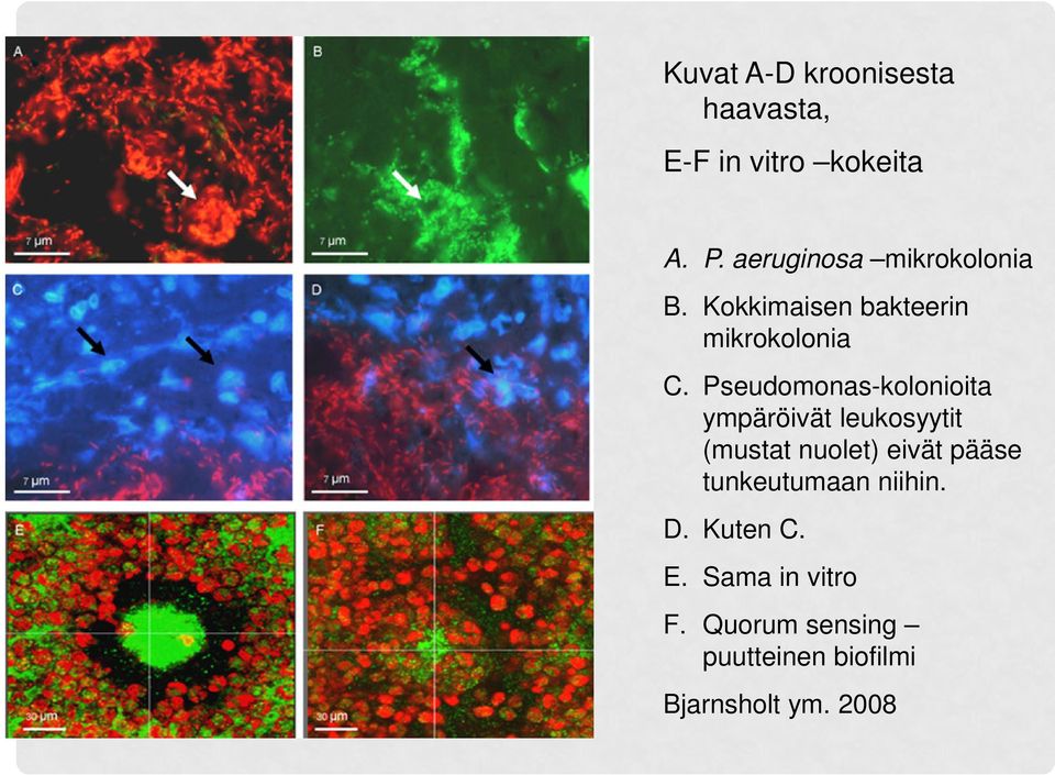 Pseudomonas-kolonioita ympäröivät leukosyytit (mustat nuolet) eivät pääse