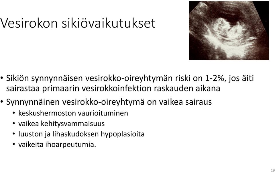 Synnynnäinen vesirokko-oireyhtymä on vaikea sairaus keskushermoston