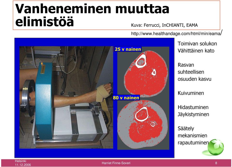 com/html/min/eama/ Woman, 25 v nainen 25 yrs Toimivan solukon Vähittäinen kato