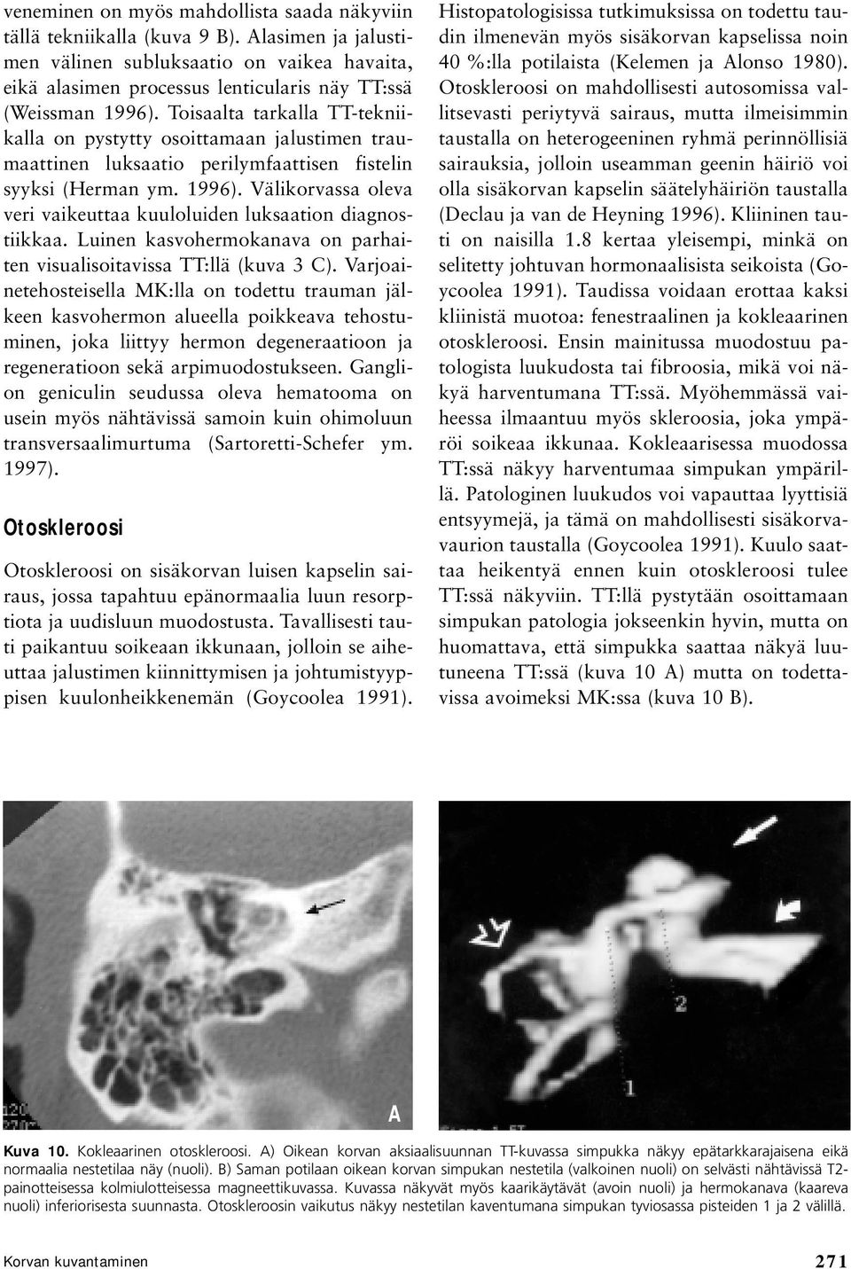 Toisaalta tarkalla TT-tekniikalla on pystytty osoittamaan jalustimen traumaattinen luksaatio perilymfaattisen fistelin syyksi (Herman ym. 1996).