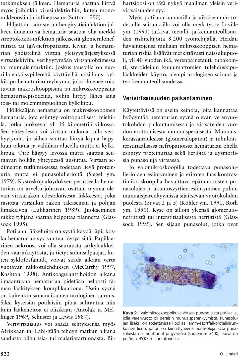 Kivun ja hematurian yhdistelmä viittaa yleisyysjärjestyksessä virtsatiekiviin, verihyytymään virtsanjohtimessa tai munuaisinfarktiin.