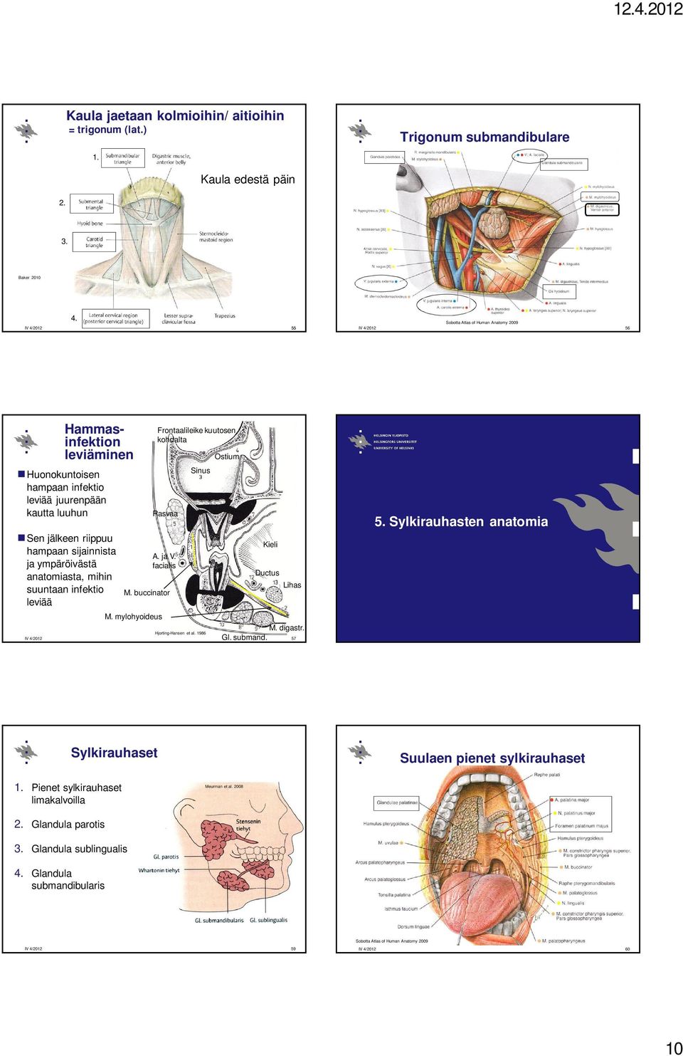 suuntaan infektio leviää Frontaalileike kuutosen kohdalta Rasvaa A. ja V. facialis M. buccinator M. mylohyoideus Sinus Hjorting-Hansen et al. 1986 Ostium Kieli Ductus Lihas M.