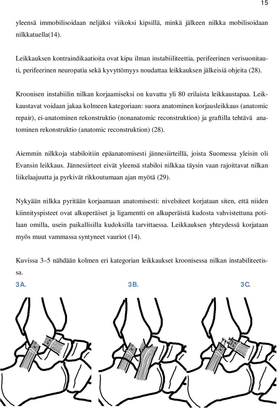 Kroonisen instabiilin nilkan korjaamiseksi on kuvattu yli 80 erilaista leikkaustapaa.