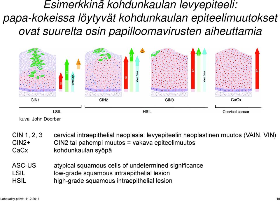 CIN2 tai pahempi muutos = vakava epiteelimuutos t CaCx kohdunkaulan syöpä ASC-US atypical squamous cells of undetermined