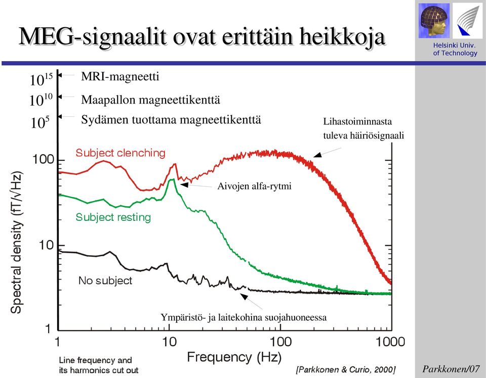 magneettikenttä Lihastoiminnasta tuleva häiriösignaali