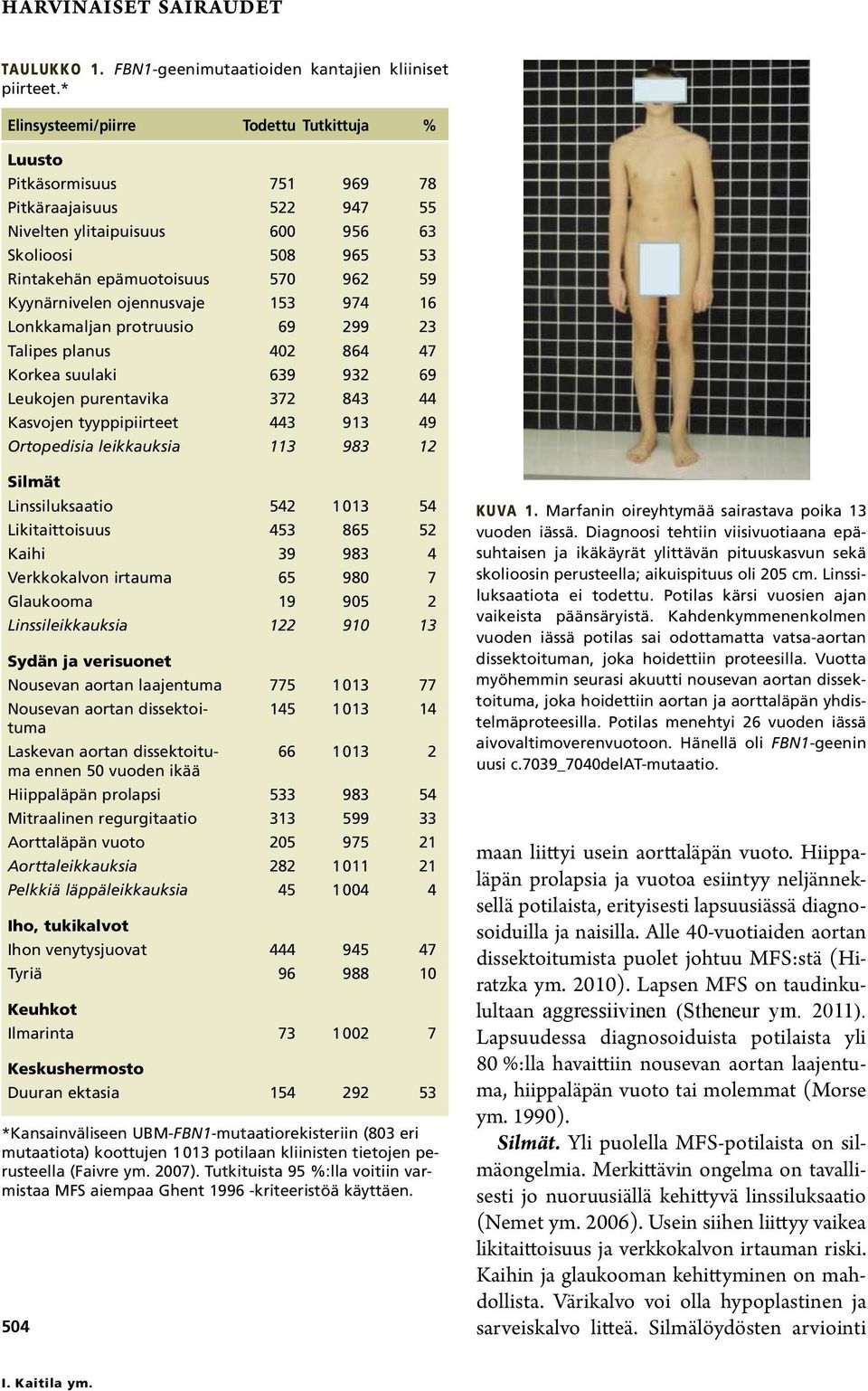 Kyynärnivelen ojennusvaje 153 974 16 Lonkkamaljan protruusio 69 299 23 Talipes planus 402 864 47 Korkea suulaki 639 932 69 Leukojen purentavika 372 843 44 Kasvojen tyyppipiirteet 443 913 49