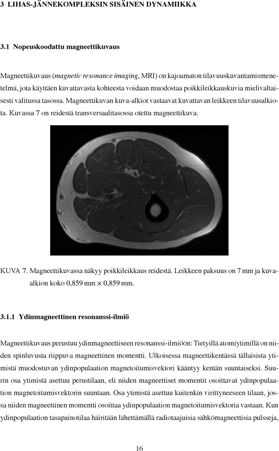 poikkileikkauskuvia mielivaltaisesti valitussa tasossa. Magneettikuvan kuva-alkiot vastaavat kuvattavan leikkeen tilavuusalkiota. Kuvassa 7 on reidestä transversaalitasossa otettu magneettikuva.