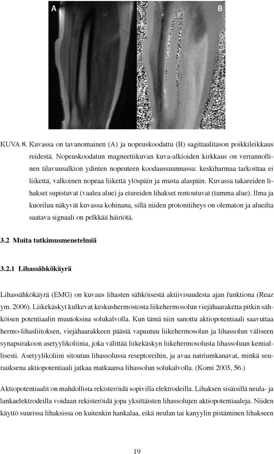 musta alaspäin. Kuvassa takareiden lihakset supistuvat (vaalea alue) ja etureiden lihakset rentoutuvat (tumma alue).