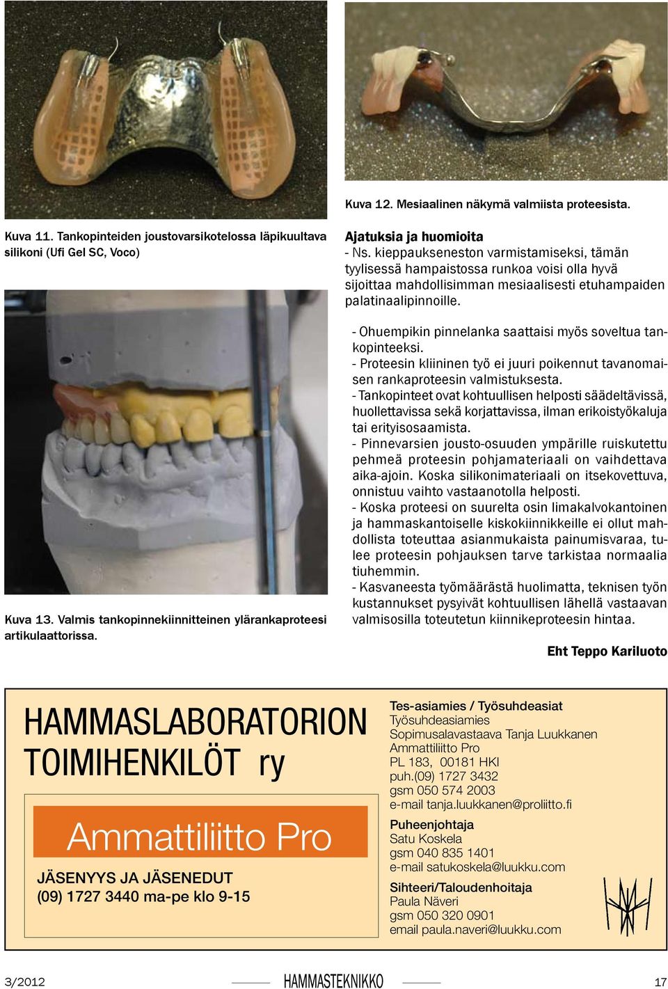 kieppaukseneston varmistamiseksi, tämän tyylisessä hampaistossa runkoa voisi olla hyvä sijoittaa mahdollisimman mesiaalisesti etuhampaiden palatinaalipinnoille.